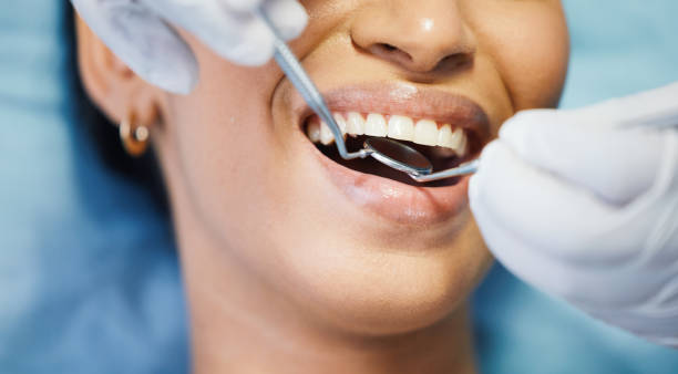 Best Broken or Chipped Tooth Repair in Forestville, MD